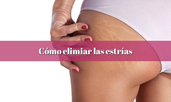 Cómo quitar las estrías